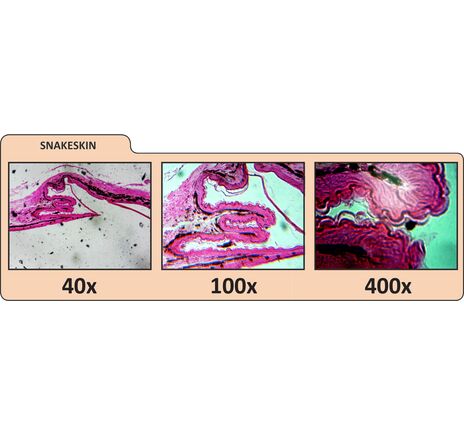LDM II - LCD Digitales Mikroskop II, image-2