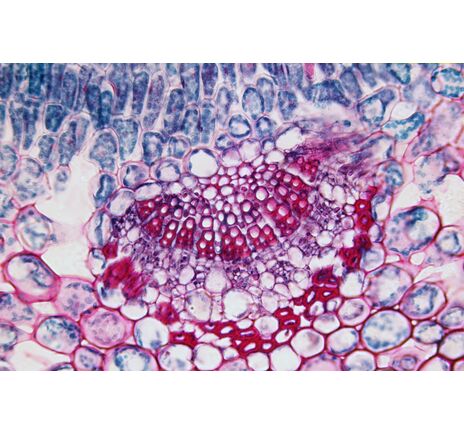 Sada trvalých preparátov BRESSER – 25 ks, image-2