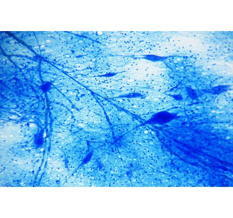 Sada trvalých preparátov BRESSER – 25 ks, image-5