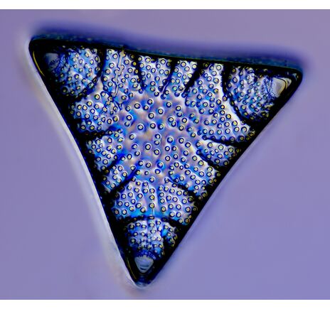 Pre mnohé profesionálne aplikácie v oblasti prírodných vied je diferenciálny interferenčný kontrast v súčasnosti štandardom. Touto metódou sa do, image-6