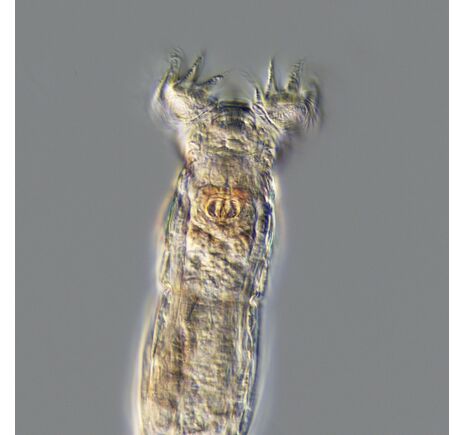 Pre mnohé profesionálne aplikácie v oblasti prírodných vied je diferenciálny interferenčný kontrast v súčasnosti štandardom. Touto metódou sa do, image-5