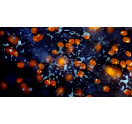 Mikroskopová kamera BRESSER MikroCamII 9 MP 4K 1", image-3