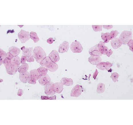 Trvalé mikroskopické preparáty BRESSER – sada 10 ks, image-5