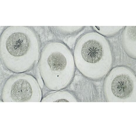 Trvalé mikroskopické preparáty BRESSER – sada 10 ks, image-3