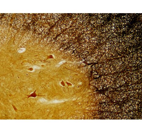 Sada trvalých preparátov BRESSER – histológia, image-3