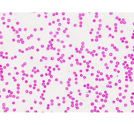 Sada trvalých preparátov BRESSER – histológia, image-7