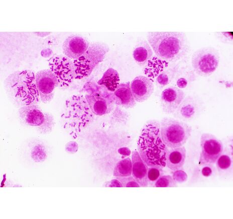 Sada trvalých preparátov BRESSER – histológia, image-2