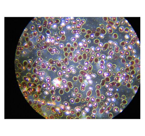 Optika Mikroskop B-383DK, trinokulárny, darkfield, N-PLAN, 100× W-PLAN, 40×–1000×, image-4