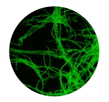 Optika Mikroskop B-510FL, trinokulárny, fluorescenčný HBO, modrý a zelený filter, W-PLAN IOS, 40×–400×, image-4