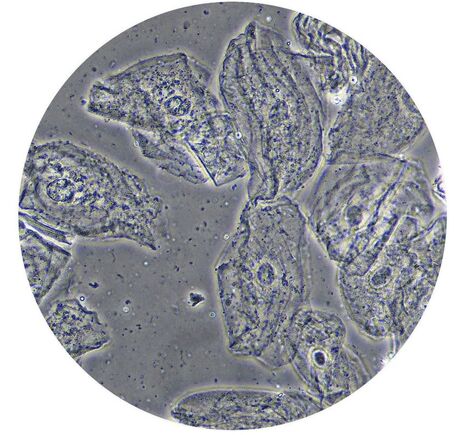 Optika Mikroskop B-510PH, fázový kontrast, trinokulárny, W-PLAN IOS, 100×–1000×, EU verzia, image-4