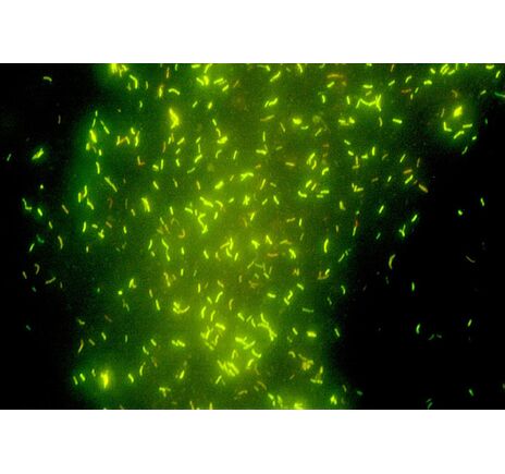 Optika Mikroskop B-293LD1, LED-FLUO, N-PLAN IOS, 1000× dry, modrý filter set, trinokulárny, image-3