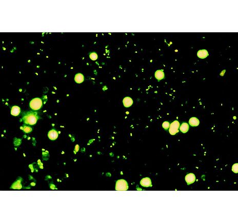 Optika Mikroskop B-292LD1.50, binokulárny, LED-FLUO, N-PLAN IOS, 500×, modrý filter set, image-2