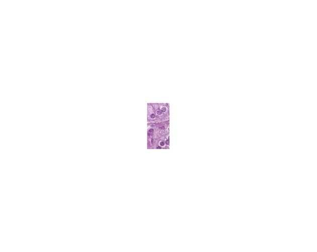 Optika Mikroskop B-383PL, trinokulárny, N-PLAN DIN, 40×–1000×, image-2