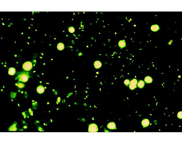 Optika Mikroskop B-292LD1, binokulárny, LED-FLUO, N-PLAN IOS, 1000× dry, modrý filter set, image-2