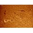 H-alfa filter LUNT LS100FHa/B1200d1, image-4